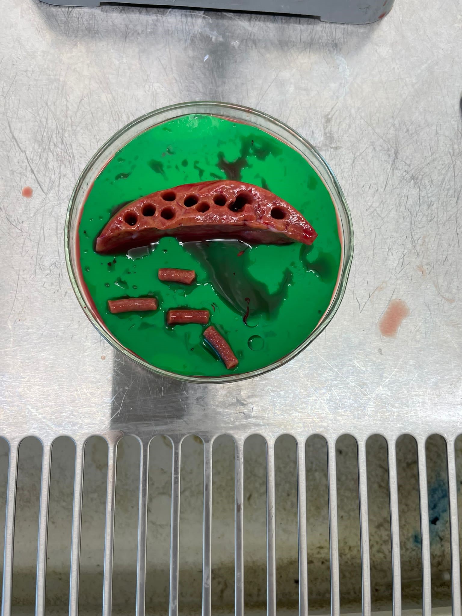 Precision Cut Tissue Slices